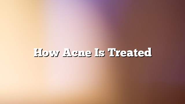 How Acne Is Treated