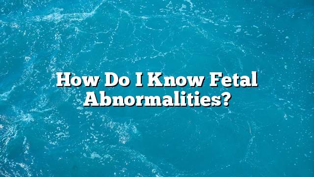 How Do I Know Fetal Abnormalities ON THE WEB TODAY