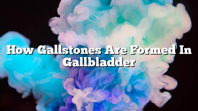 How gallstones are formed in gallbladder