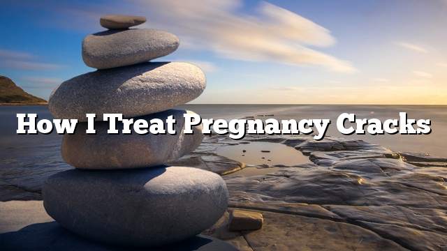 How I treat pregnancy cracks