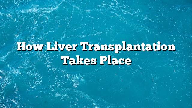 How liver transplantation takes place