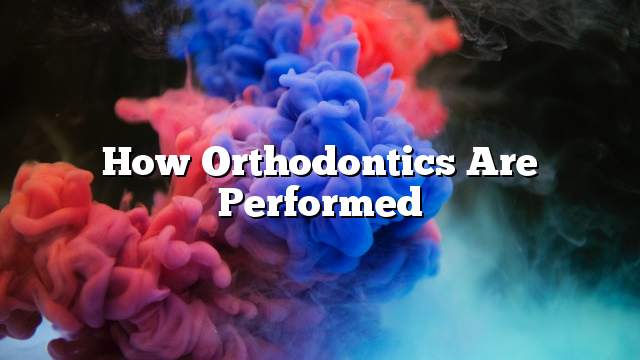 How orthodontics are performed