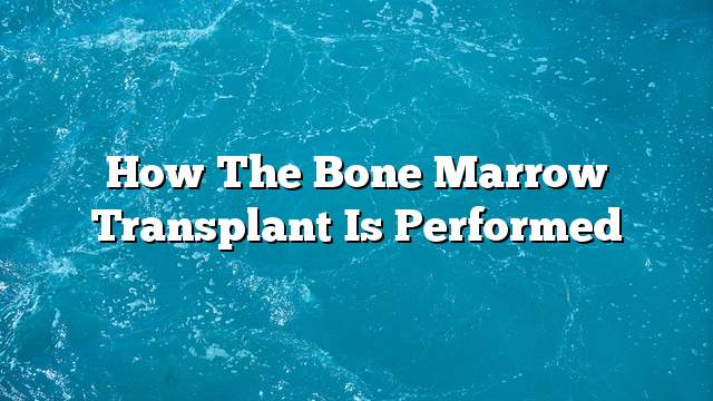 How the bone marrow transplant is performed