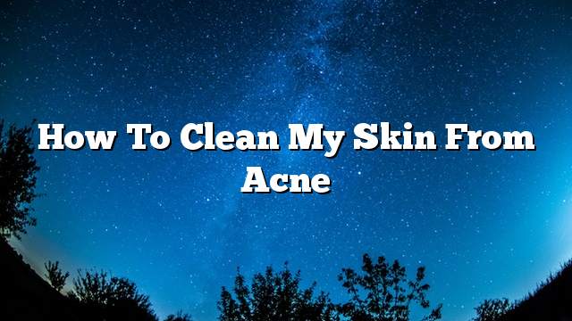 How to clean my skin from acne