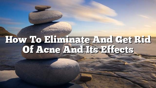 How to Eliminate and Get rid of acne and its effects