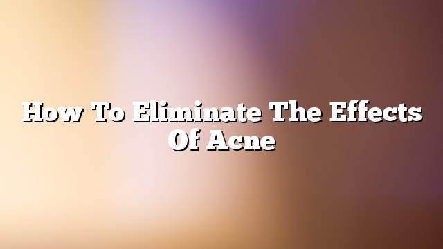 How to Eliminate the Effects of Acne