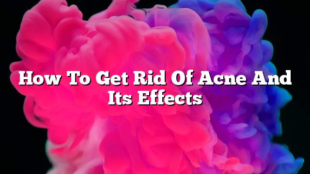 How To Get Rid Of Acne And Its Effects