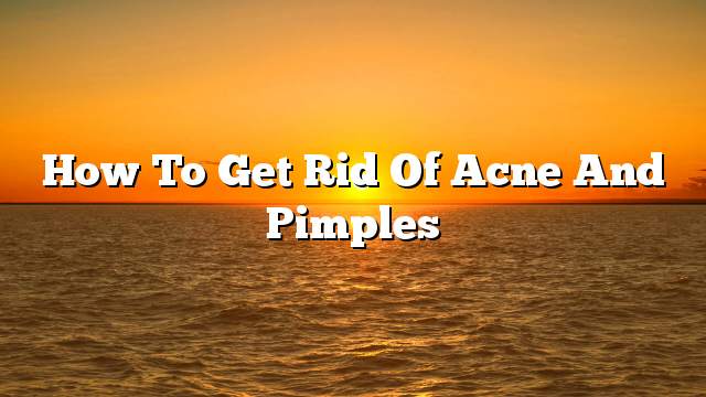 How to get rid of acne and pimples