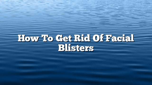 How to get rid of facial blisters