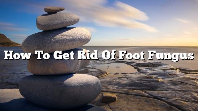 How to get rid of foot fungus