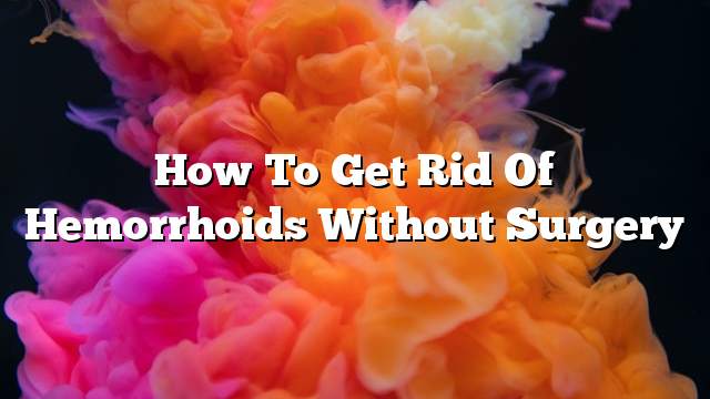 How to get rid of hemorrhoids without surgery