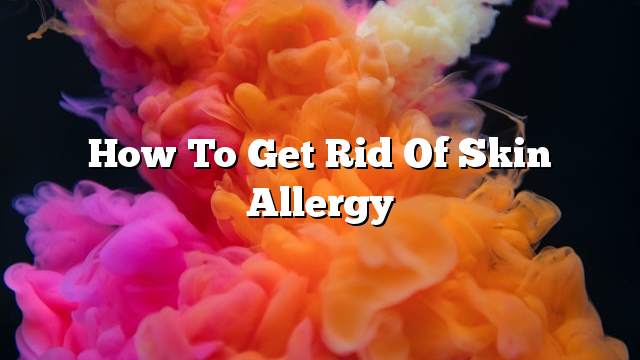 How to get rid of skin allergy