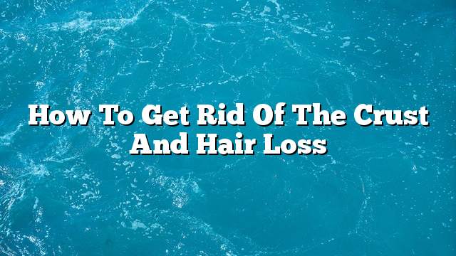 How to get rid of the crust and hair loss