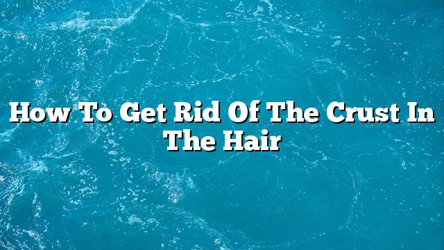 How to get rid of the crust in the hair