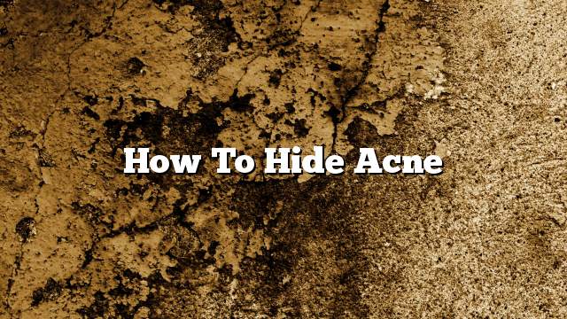 How to hide acne