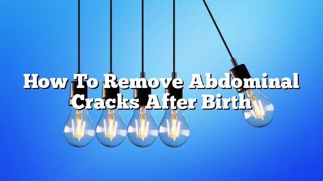 How to remove abdominal cracks after birth