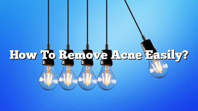 How to remove acne easily?