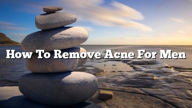 How To Remove Acne For Men