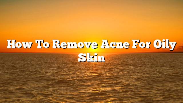 How to remove acne for oily skin