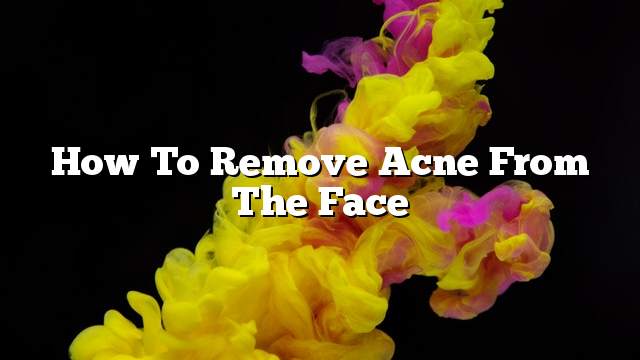 How to remove acne from the face