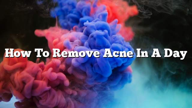 How To Remove Acne In A Day