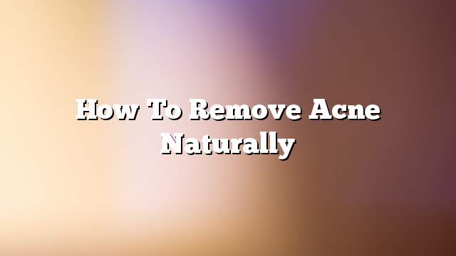 How To Remove Acne Naturally