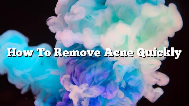 How To Remove Acne Quickly