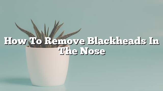 How to remove blackheads in the nose