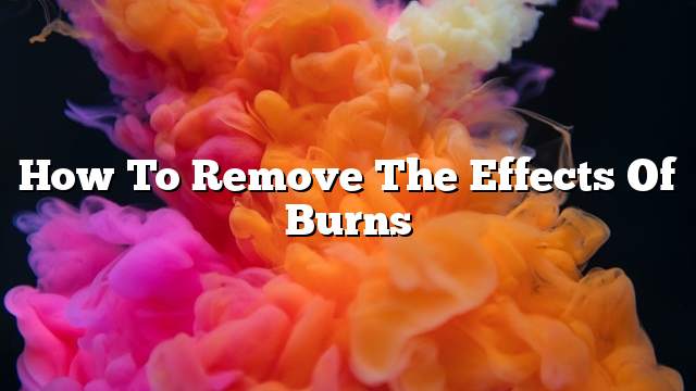 How to remove the effects of burns