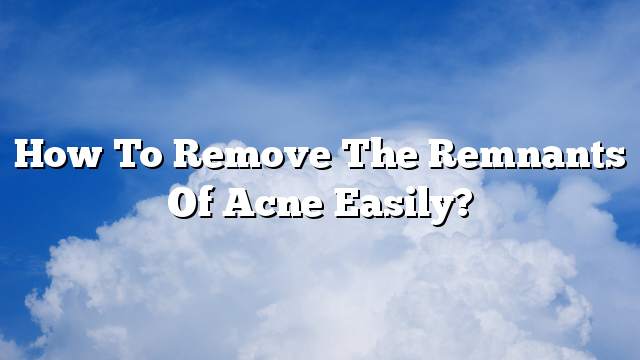 How to remove the remnants of acne easily?