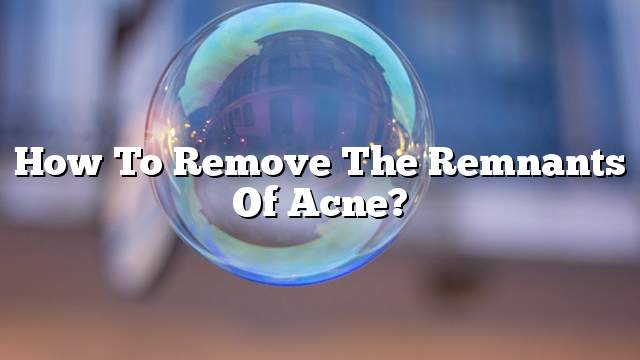 How to remove the remnants of acne?