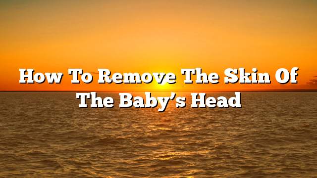 How to remove the skin of the baby’s head