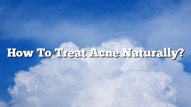 How to treat acne naturally?