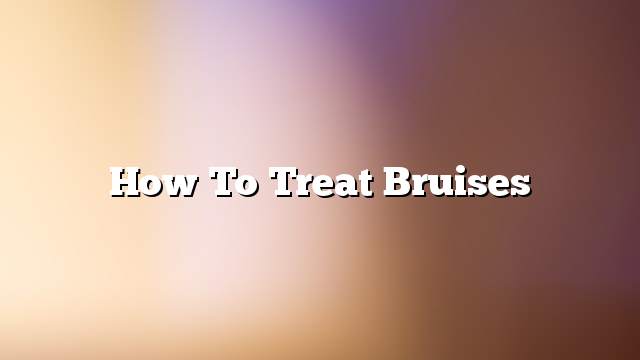 How to treat bruises