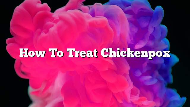 How to treat chickenpox