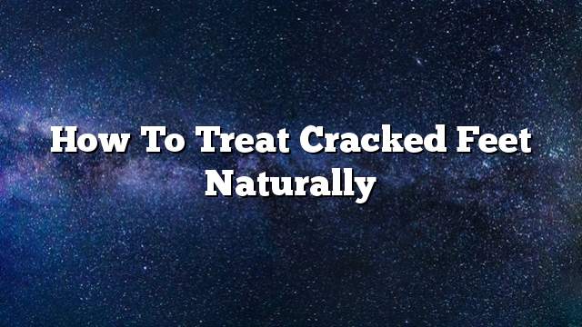 How to treat cracked feet naturally