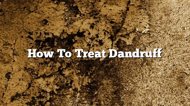 How to treat dandruff