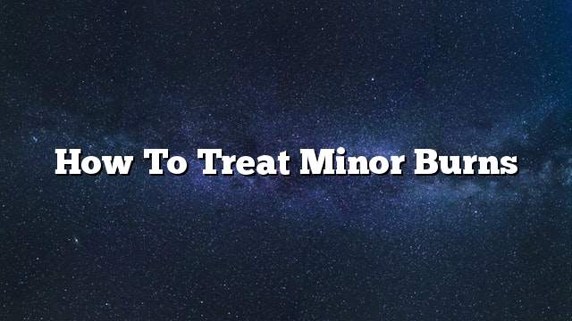 How to treat minor burns