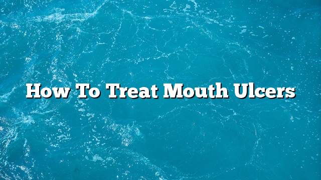 How to treat mouth ulcers