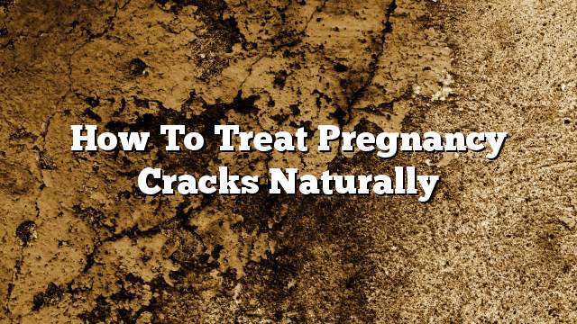 How to treat pregnancy cracks naturally