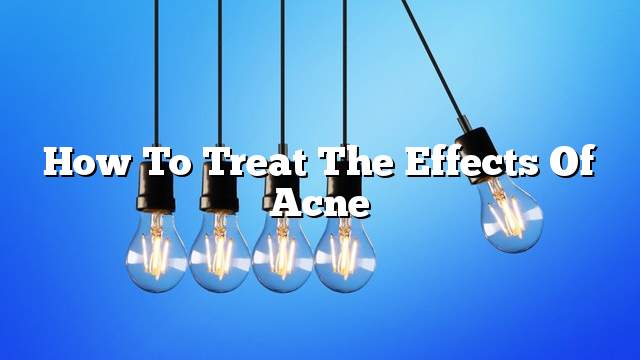 How to treat the effects of acne