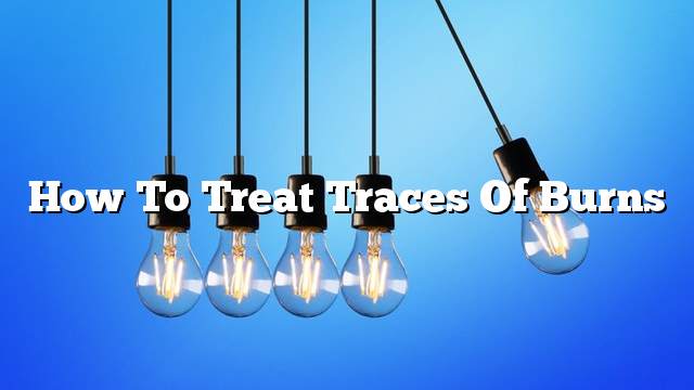 How to treat traces of burns