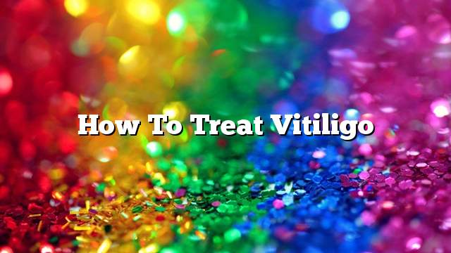 How to treat vitiligo