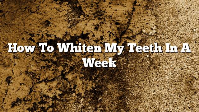 How to whiten my teeth in a week