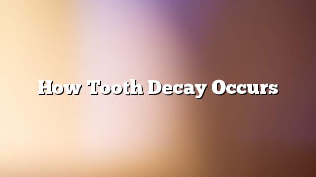 How tooth decay occurs