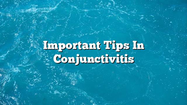 Important Tips in Conjunctivitis