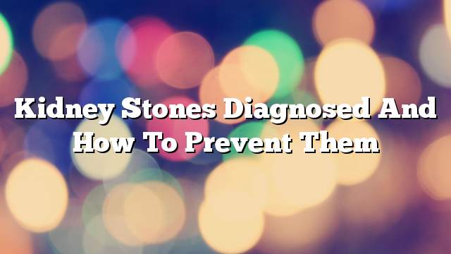 Kidney stones diagnosed and how to prevent them