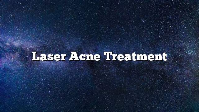 Laser acne treatment