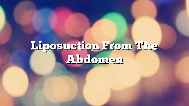 Liposuction from the abdomen