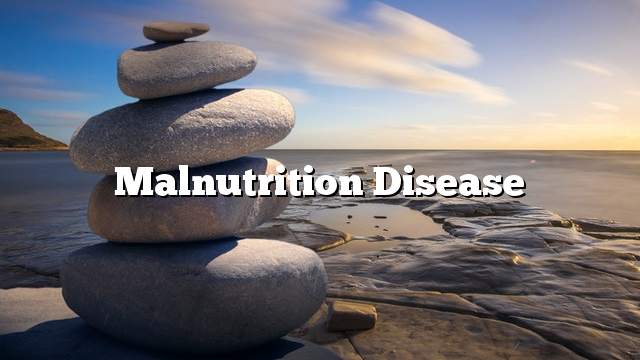 Malnutrition disease